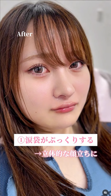 ルラ（LULA）美容クリニックの症例写真[アフター]