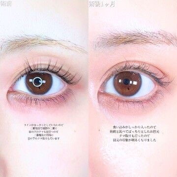 アリエル美容クリニック 大宮院の二重の症例写真