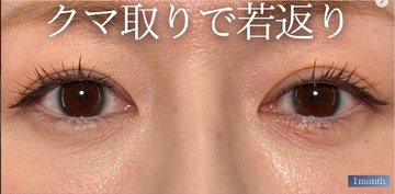 PRISM Beauty Clinicの症例写真[アフター]