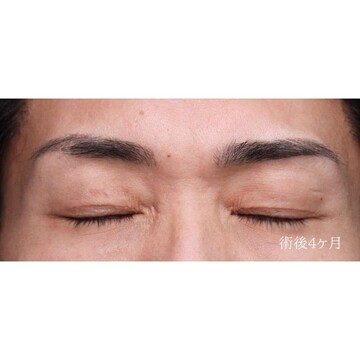 聖心美容クリニックの症例写真[アフター]