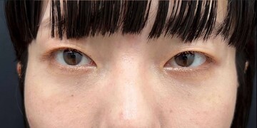 AI Beauty Clinicの症例写真[アフター]