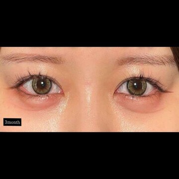 PRISM Beauty Clinicの症例写真[アフター]
