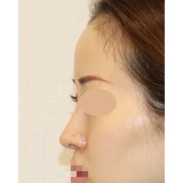 聖心美容クリニックの症例写真[アフター]