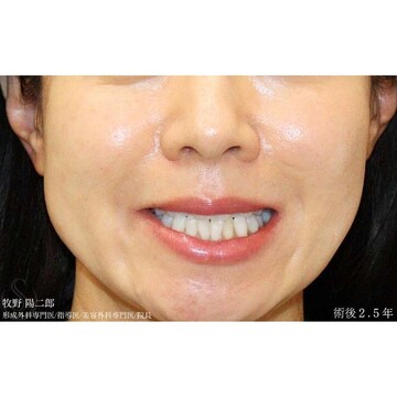 聖心美容クリニックの症例写真[アフター]