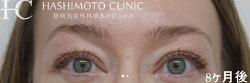 静岡美容外科橋本クリニックの症例写真[アフター]