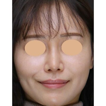 聖心美容クリニックの症例写真[アフター]