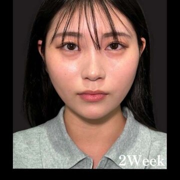 PRISM Beauty Clinicの症例写真[アフター]
