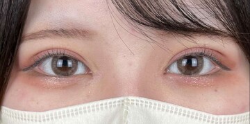 AI Beauty Clinicの症例写真[アフター]