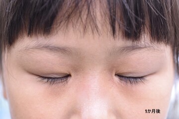 医療法人秀晄会 心斎橋コムロ美容外科クリニックの症例写真[アフター]