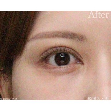 聖心美容クリニックの症例写真[アフター]