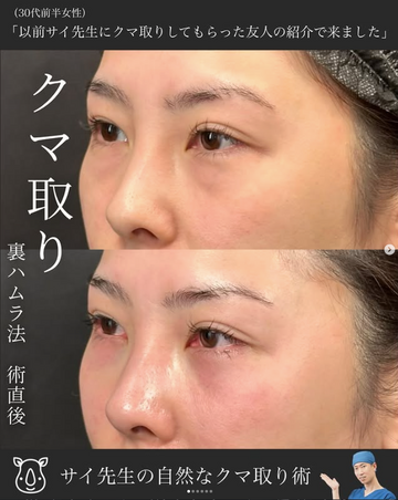 SAI CLINIC （サイクリニック）の目元・クマ・眉下・涙袋整形の症例写真