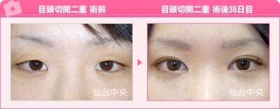 ご来院の動機・お悩み