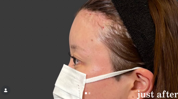 Plume Clinicの症例写真[アフター]