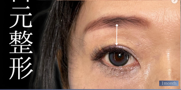 PRISM Beauty Clinicの症例写真[アフター]