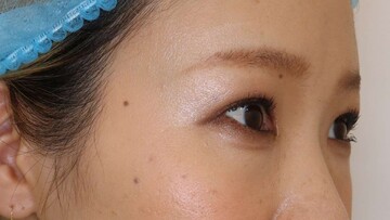 すなおクリニックの症例写真[アフター]