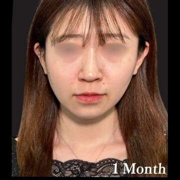 PRISM Beauty Clinicの症例写真[アフター]