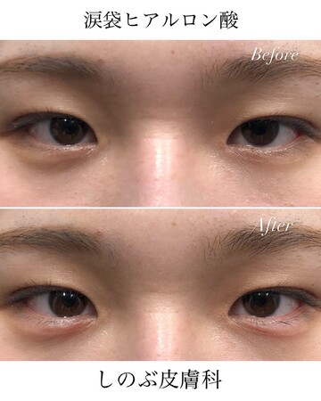 しのぶ皮膚科の目元の症例写真
