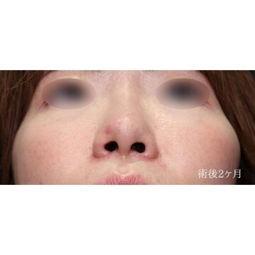 聖心美容クリニックの症例写真[アフター]