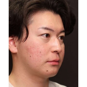 聖心美容クリニックの目元の症例写真[ビフォー]