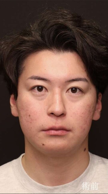 聖心美容クリニックの目元の症例写真[ビフォー]