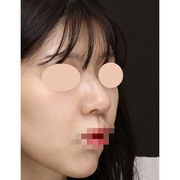 聖心美容クリニックの症例写真[アフター]