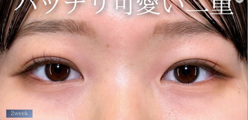 PRISM Beauty Clinicの症例写真[アフター]