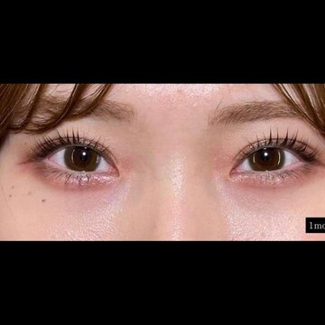 PRISM Beauty Clinicの症例写真[アフター]