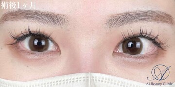 AI Beauty Clinicの症例写真[アフター]