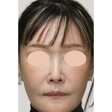 聖心美容クリニックの症例写真[アフター]