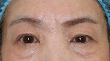 すなおクリニックの症例写真[アフター]
