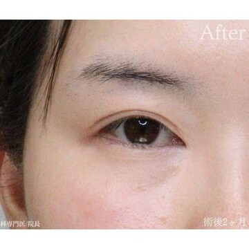 聖心美容クリニックの症例写真[アフター]