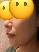 ペルラクリニック神宮前の症例写真[アフター]