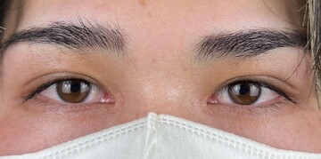 AI Beauty Clinicの症例写真[アフター]