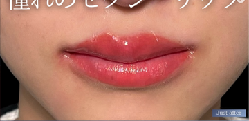 PRISM Beauty Clinicの症例写真[アフター]