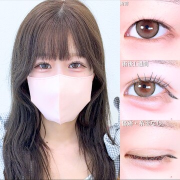 アリエル美容クリニック 大宮院の二重の症例写真