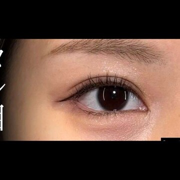 PRISM Beauty Clinicの症例写真[アフター]