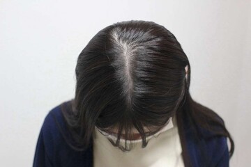 AGAスキンクリニックのアートメイクの症例写真[ビフォー]
