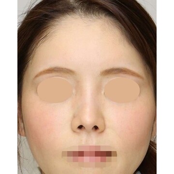 聖心美容クリニックの症例写真[アフター]