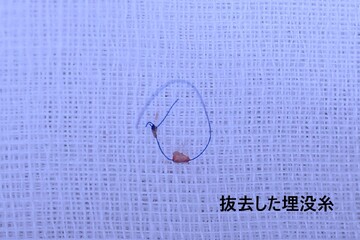 医療法人秀晄会 心斎橋コムロ美容外科クリニックの目・二重整形の症例写真
