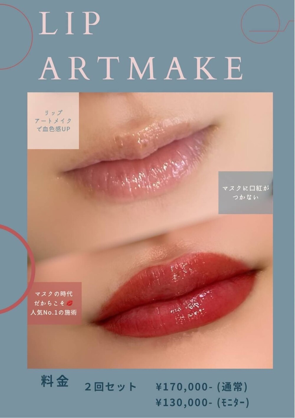 リップアートメイク アートメイクの症例写真 画像 美容皮膚科 Bella Beauty Clinic 大阪心斎橋院 ベラビューティークリニック Cs 美容医療の口コミ広場