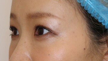 すなおクリニックの症例写真[アフター]