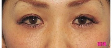 湘南美容クリニック 熊本院の症例写真[アフター]