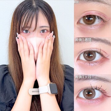 アリエル美容クリニック 大宮院の二重の症例写真