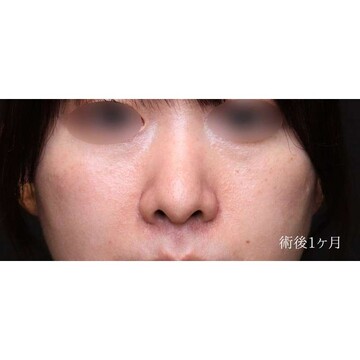 聖心美容クリニックの症例写真[アフター]