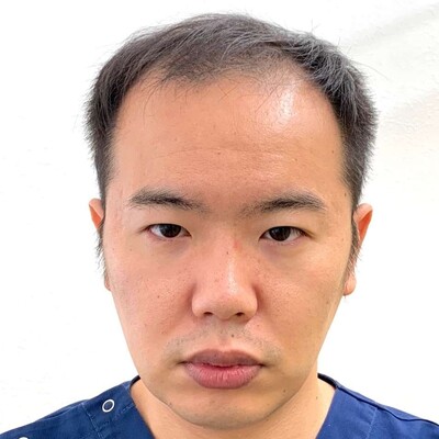 Rebirth+ミノキジェット｜40代｜12か月の症例写真[ビフォー]