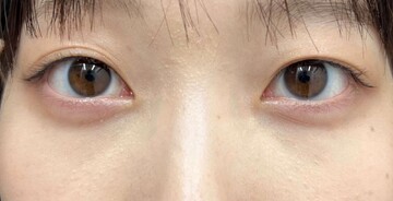 AI Beauty Clinicの症例写真[アフター]