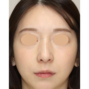 聖心美容クリニックの症例写真[アフター]