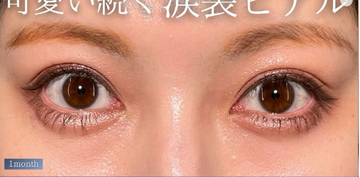PRISM Beauty Clinicの症例写真[アフター]
