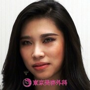 口コミ広場 鼻のヒアルロン酸注入 尾道市 口コミ 美容外科0件