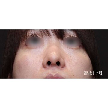 聖心美容クリニックの症例写真[アフター]